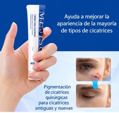 Scar Removal Cream™ — Crema para mejorar la apariencia de cicatrices