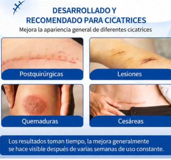 Scar Removal Cream™ — Crema para mejorar la apariencia de cicatrices